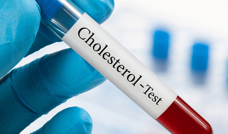 Tips To Lower Cholesterol
